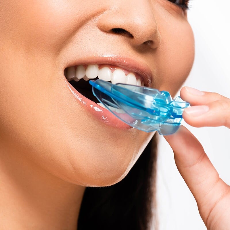 Mouthguards